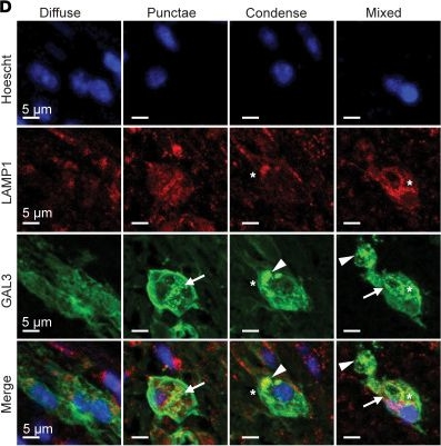 Fig.4.D showing Immunocytochemistry-immunofluorescence in a Mus musculus (House mouse) sample from the publication: Peroxisomal integrity in demyelination-associated microglia enables cellular debris clearance and myelin renewal in mice.