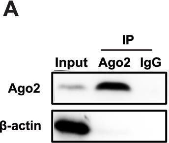 Fig.4.A showing Western Blotting from the publication: CircVAPA promotes small cell lung cancer progression by modulating the miR-377-3p and miR-494-3p/IGF1R/AKT axis.