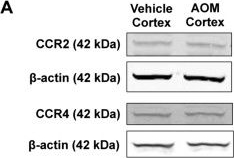 Fig.3.A showing Western Blotting in a Mus musculus (House mouse) sample from the publication: Neuronal CCL2 is upregulated during hepatic encephalopathy and contributes to microglia activation and neurological decline.
