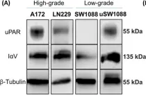 Fig.1.A showing Western Blotting from the publication: N-Glycosylation as a Key Requirement for the Positive Interaction of Integrin and uPAR in Glioblastoma.