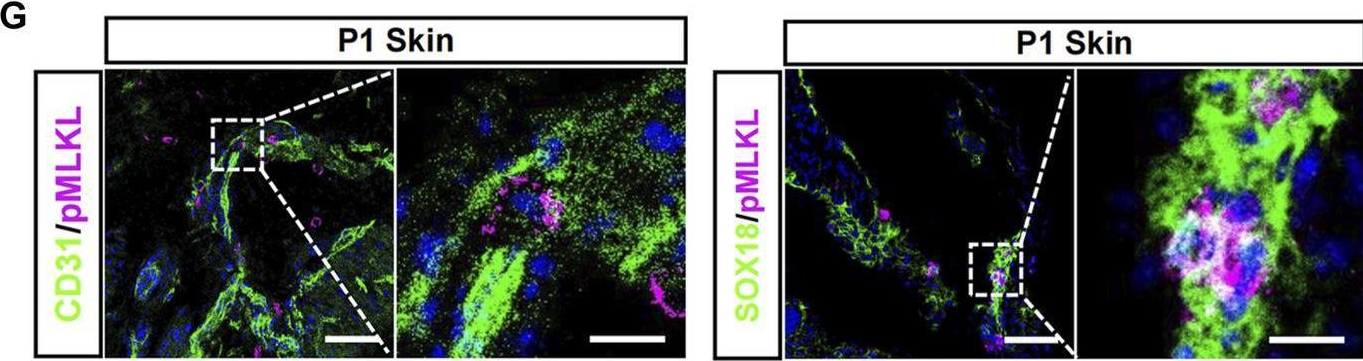 Fig.1.G showing Immunohistochemistry-immunofluorescence in a Mus musculus (House mouse) sample from the publication: Evidence for developmental vascular-associated necroptosis and its contribution to venous-lymphatic endothelial differentiation.