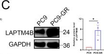 Fig.2.C showing Western Blotting in a Homo sapiens (Human) sample from the publication: LAPTM4B Confers Resistance to EGFR-TKIs by Suppressing the Proteasomal Degradation of ATP1A1 in Non-small Cell Lung Cancer.