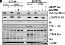 Fig.3.B showing Western Blotting in a Homo sapiens (Human) sample from the publication: Sustained activation of the AKT/mTOR and MAP kinase pathways mediate resistance to the Src inhibitor, dasatinib, in thyroid cancer.