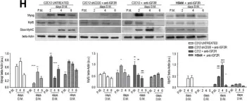 Fig.2.H showing Western Blotting in a Mus musculus (House mouse) sample from the publication: Blockade of IGF2R improves muscle regeneration and ameliorates Duchenne muscular dystrophy.