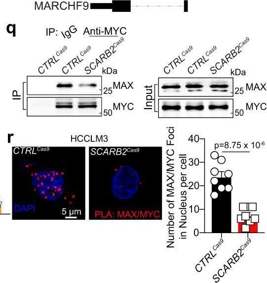 Fig.3.Q showing Immunocytochemistry-immunofluorescence from the publication: SCARB2 drives hepatocellular carcinoma tumor initiating cells via enhanced MYC transcriptional activity.