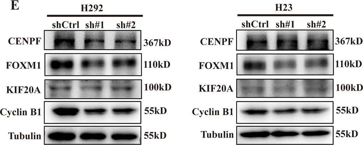 Fig.3.E showing Western Blotting from the publication: Long noncoding RNA SH3PXD2A-AS1 promotes NSCLC proliferation and accelerates cell cycle progression by interacting with DHX9.