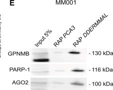 Fig.4.E showing Western Blotting from the publication: DDERMMAL, a melanocytic long non-coding RNA, confers DNA damage tolerance to melanoma cells.