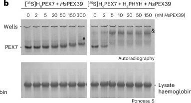 Fig.4.B showing Western Blotting from the publication: PEX39 facilitates the peroxisomal import of PTS2-containing proteins.