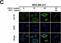 IGF-I Receptor beta Antibody | Cell Signaling Technology
