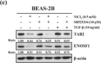 Fig.4.C showing Western Blotting in a Homo sapiens (Human) sample from the publication: Upregulation of microRNA-4417 and Its Target Genes Contribute to Nickel Chloride-promoted Lung Epithelial Cell Fibrogenesis and Tumorigenesis.
