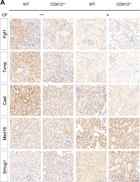 Fig.9.A showing Immunohistochemistry from the publication: Tubule-specific cyclin-dependent kinase 12 knockdown potentiates kidney injury through transcriptional elongation defects.