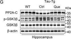 PP2A C Subunit (52F8) Rabbit Monoclonal Antibody | Cell Signaling