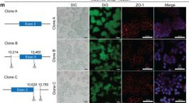 ZO-1 (D6L1E) Rabbit Monoclonal Antibody | Cell Signaling Technology
