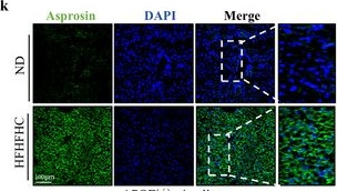 Fig.1.K showing Immunohistochemistry-immunofluorescence from the publication: Asprosin-FABP5 Interaction Modulates Mitochondrial Fatty Acid Oxidation through PPARα Contributing to MASLD Development.