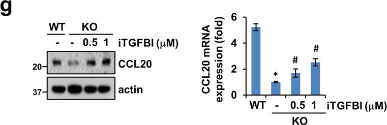 Fig.4.G showing Western Blotting from the publication: Cathepsin D promotes polarization of tumor-associated macrophages and metastasis through TGFBI-CCL20 signaling.
