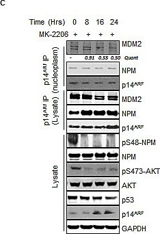 Fig.4.C showing Western Blotting in a Homo sapiens (Human) sample from the publication: AKT regulates NPM dependent ARF localization and p53mut stability in tumors.