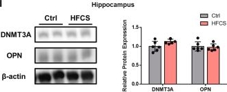 Fig.5.I showing Western Blotting from the publication: Neural stem cells as potential mediators of prenatal dietary stress through epigenetic mechanisms.