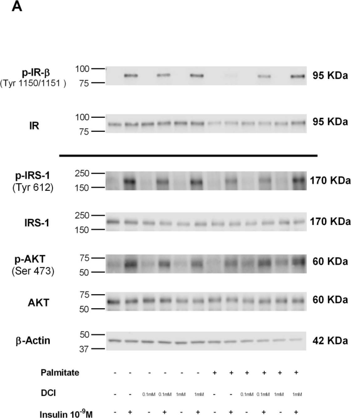 irs1 antibodies Antibody search engine CiteAb