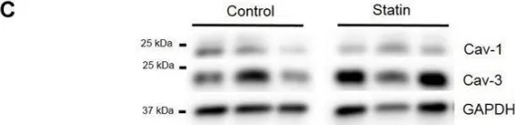 Fig.9.C showing Western Blotting from the publication: Simvastatin Promotes Cardiac Myocyte Relaxation in Association with Phosphorylation of Troponin I.