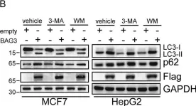 Fig.2.B showing Western Blotting in a Homo sapiens (Human) sample from the publication: BAG3 promotes autophagy and glutaminolysis via stabilizing glutaminase.