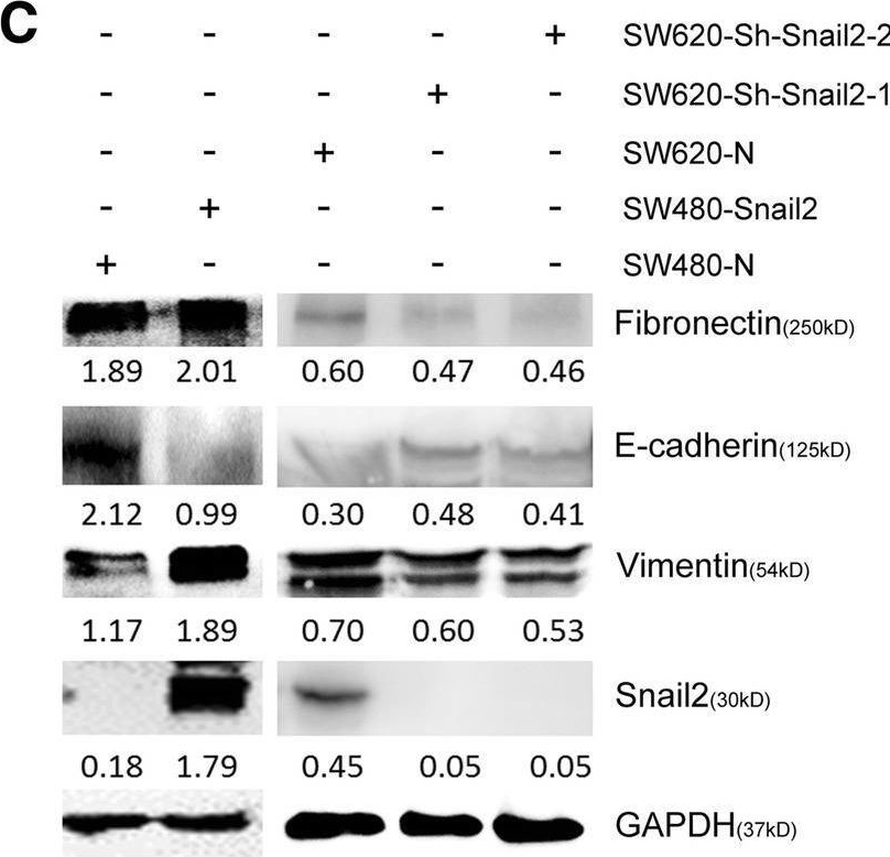 Fig.3.C showing Western Blotting from the publication: Epigenetic suppression of E-cadherin expression by Snail2 during the metastasis of colorectal cancer.