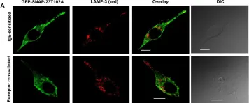 Fig.5.A showing Immunocytochemistry-immunofluorescence in a Rattus norvegicus (Rat) sample from the publication: Phosphorylation of SNAP-23 regulates its dynamic membrane association during mast cell exocytosis.