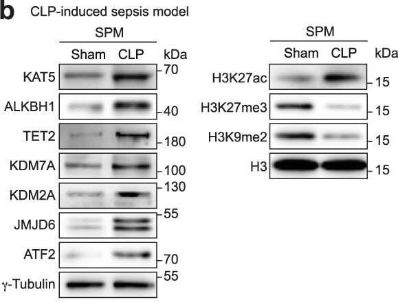 Fig.10.B showing Western Blotting in a Homo sapiens (Human) sample from the publication: A druggable copper-signalling pathway that drives inflammation.
