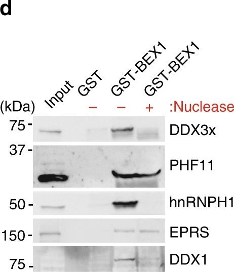 Fig.3.D showing Western Blotting in a Mus musculus (House mouse) sample from the publication: BEX1 is an RNA-dependent mediator of cardiomyopathy.