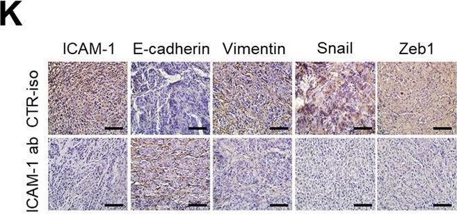 Fig.5.K showing Immunohistochemistry from the publication: ICAM-1 promotes cancer progression by regulating SRC activity as an adapter protein in colorectal cancer.