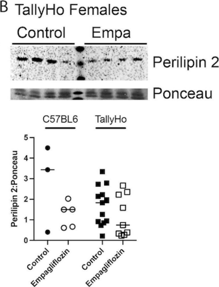 Empagliflozin Treatment Attenuates Hepatic Steatosis by Promoting White Adipose Expansion in Obese TallyHo Mice.