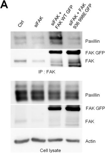 Fig.6.A showing Western Blotting in a Homo sapiens (Human) sample from the publication: Inhibiting FAK-Paxillin Interaction Reduces Migration and Invadopodia-Mediated Matrix Degradation in Metastatic Melanoma Cells.