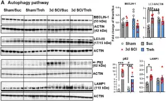 Fig.9.A showing Western Blotting in a Mus musculus (House mouse) sample from the publication: Impairment of autophagy after spinal cord injury potentiates neuroinflammation and motor function deficit in mice.