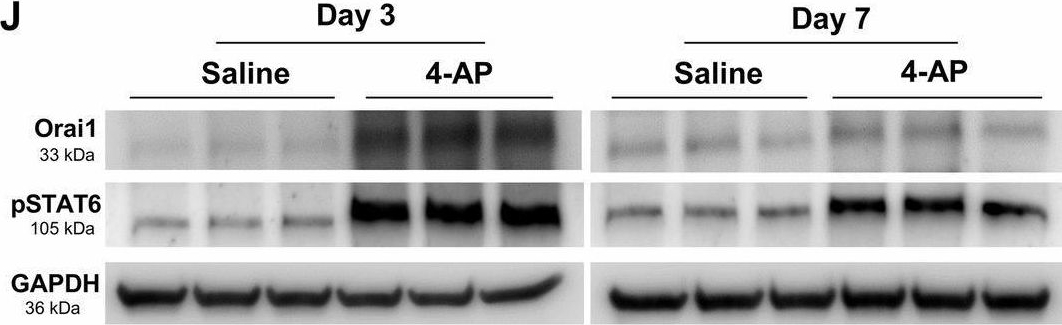 Fig.3.J showing Western Blotting in a Mus musculus (House mouse) sample from the publication: 4-aminopyridine attenuates inflammation and apoptosis and increases angiogenesis to promote skin regeneration following a burn injury in mice.
