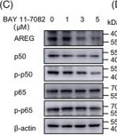Fig.5.C showing Western Blotting from the publication: STK25 inhibits cancer-associated fibroblast activation to overcome cetuximab resistance in colorectal cancer.