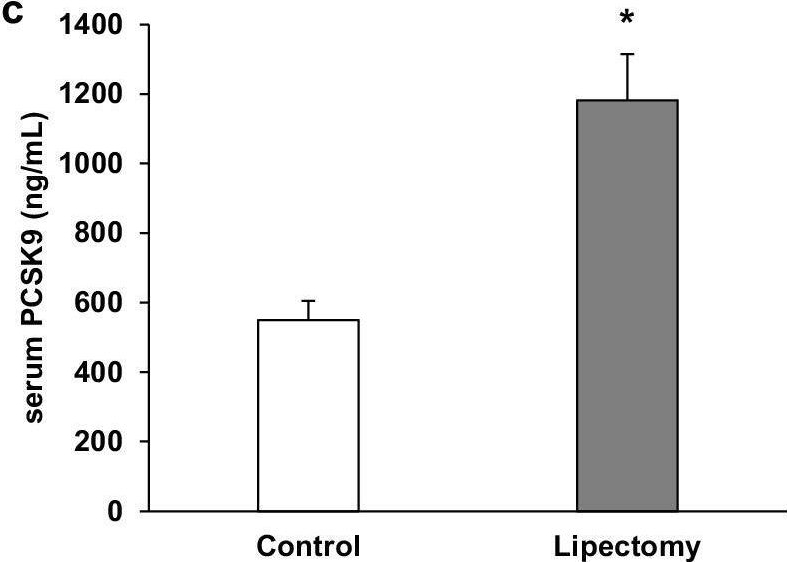 Fig.4.C showing Enzyme-linked immunosorbent assay from the publication: Up-regulation of PCSK9 gene expression and diminished level of LDL-receptor in rat liver as a potential cause of post-lipectomy hypercholesterolemia.