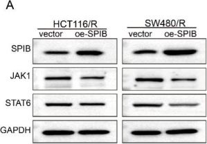 Fig.5.A showing Western Blotting from the publication: tsRNA-GlyGCC promotes colorectal cancer progression and 5-FU resistance by regulating SPIB.