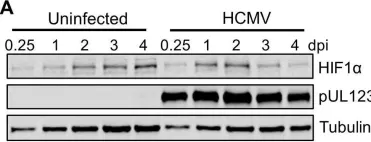 Fig.1.A showing Western Blotting from the publication: Hypoxia-Inducible Factor 1α (HIF1α) Suppresses Virus Replication in Human Cytomegalovirus Infection by Limiting Kynurenine Synthesis.