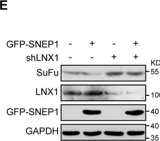 Fig.4.E showing Western Blotting from the publication: Positive feedback of SuFu negating protein 1 on Hedgehog signaling promotes colorectal tumor growth.