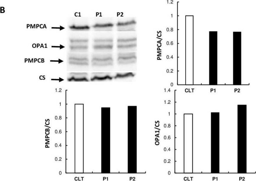 Fig.2.B showing Western Blotting in a Homo sapiens (Human) sample from the publication: Next-Generation Sequencing Identifies Novel PMPCA Variants in Patients with Late-Onset Dominant Optic Atrophy.