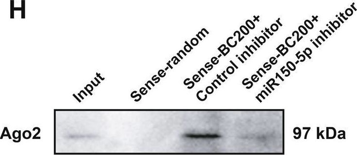 Fig.2.H showing Western Blotting from the publication: LncRNA BC200/miR-150-5p/MYB positive feedback loop promotes the malignant proliferation of myelodysplastic syndrome.