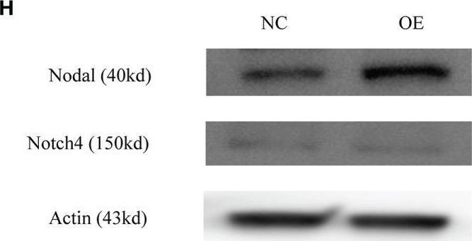 Fig.7.H showing Western Blotting in a Homo sapiens (Human) sample from the publication: The Angiotensin-Converting Enzyme Inhibitory State Promotes the Transformation of Non-Small Cell Lung Cancer Blood Supply Pattern Toward Vasculogenic Mimicry Formation.