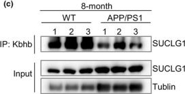 Fig.3.C showing Western Blotting from the publication: Ketogenic β-hydroxybutyrate regulates β-hydroxybutyrylation of TCA cycle-associated enzymes and attenuates disease-associated pathologies in Alzheimer's mice.