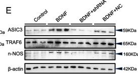 Fig.9.E showing Western Blotting in a Mus musculus (House mouse) sample from the publication: Inhibiting BDNF/TrkB.T1 receptor improves resiniferatoxin-induced postherpetic neuralgia through decreasing ASIC3 signaling in dorsal root ganglia.