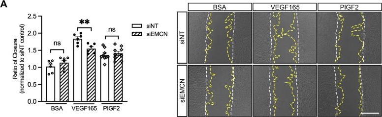 Fig.4.A from the publication: Endomucin selectively regulates vascular endothelial growth factor receptor-2 endocytosis through its interaction with AP2.