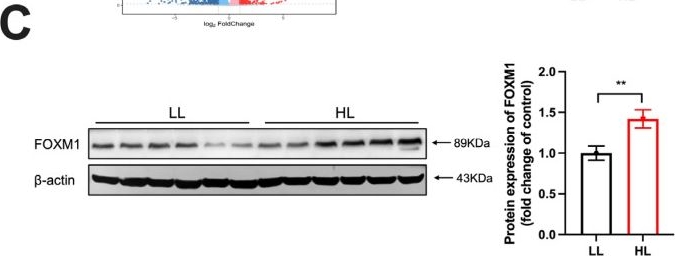 Fig.3.C showing Western Blotting from the publication: 5-HEPE Ameliorates Aging of Duck Ovarian Granulosa Cells by Targeting FOXM1 and Suppressing Oxidative Stress.