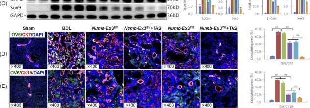 Fig.3.L showing Immunohistochemistry-immunofluorescence from the publication: Synergistic amelioration of cholestatic liver fibrosis by combined total astragalus saponins and AAV8.Numb-Exon3 through modulation of hepatic progenitor cell differentiation.