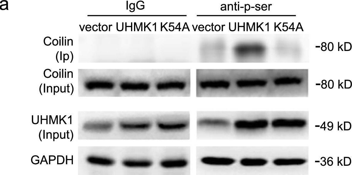 Fig.5.A showing Western Blotting in a Homo sapiens (Human) sample from the publication: UHMK1-dependent phosphorylation of Cajal body protein coilin alters 5-FU sensitivity in colon cancer cells.