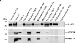 Fig.8.A showing Western Blotting in a Homo sapiens (Human) sample from the publication: IL-2 and TCR stimulation induce expression and secretion of IL-32β by human T cells.