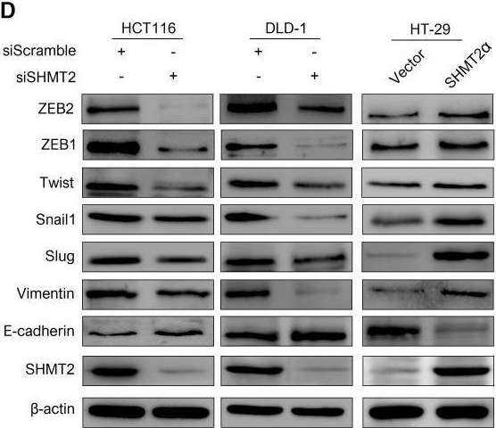 Fig.2.D showing Western Blotting from the publication: Cytoplasmic SHMT2 drives the progression and metastasis of colorectal cancer by inhibiting β-catenin degradation.