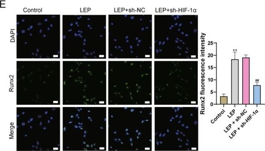 Fig.5.E showing Immunocytochemistry-immunofluorescence in a Rattus norvegicus (Rat) sample from the publication: Leptin Regulates Intervertebral Disc Calcification and Ossification by Promoting Glycolysis Through OCN/HIF-1α Axis.